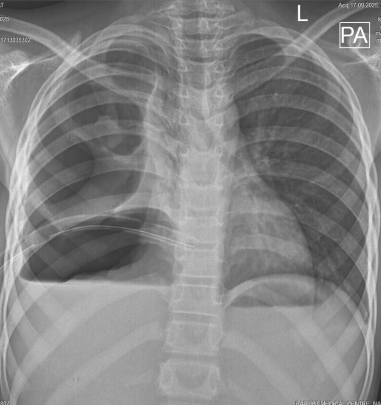 17092025-NS-preop-1-752x800.jpeg